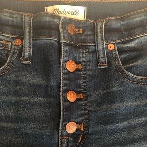 Madewell 10-inch High-waist Skinny Jeans